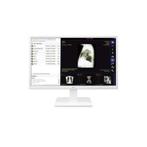 LG 24CK560N-3A All-in-One PC/workstation 60.5 cm (23.8") 1920 x 1080 pixels AMD G 4 GB DDR4-SDRAM 32 GB SSD Wi-Fi 4 (802.11n) White